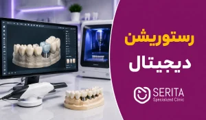 رستوریشن دیجیتال چیست و چگونه دقت پروتز دندان و ایمپلنت را افزایش می‌دهد؟